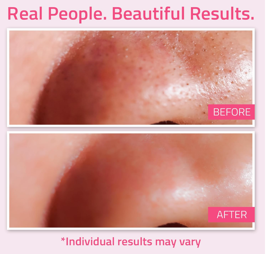 YEOUTH Dead Sea Mud Mask – Purifying Face Mask with Hyaluronic Acid & Avocado Oil (8oz)