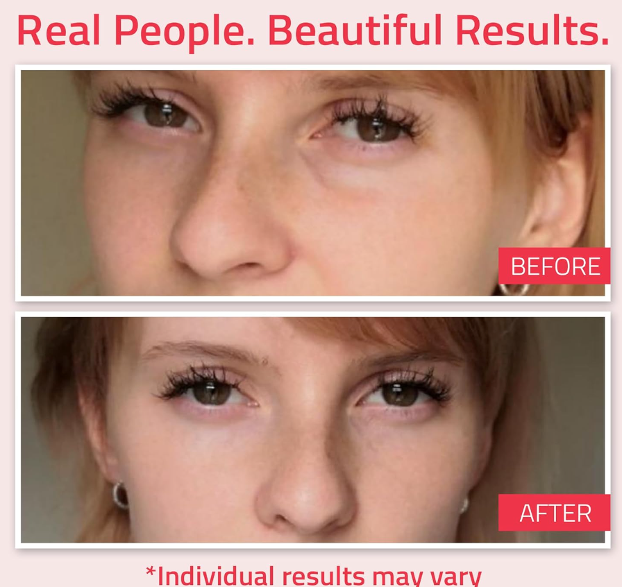 YEOUTH Retinol Eye Cream – Firming Under-Eye Cream with Hyaluronic Acid (1oz)