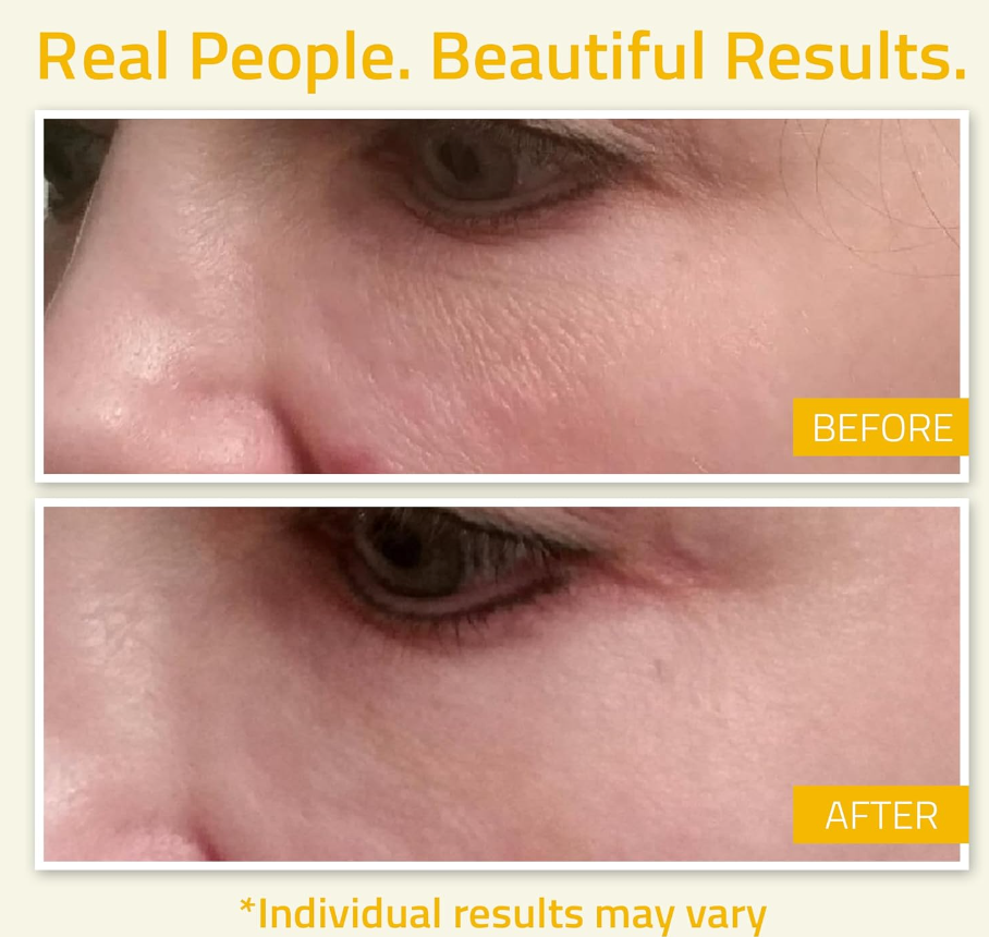 YEOUTH Niacinamide Serum – 10% B3 with Hyaluronic Acid & Aloe Vera (1oz)