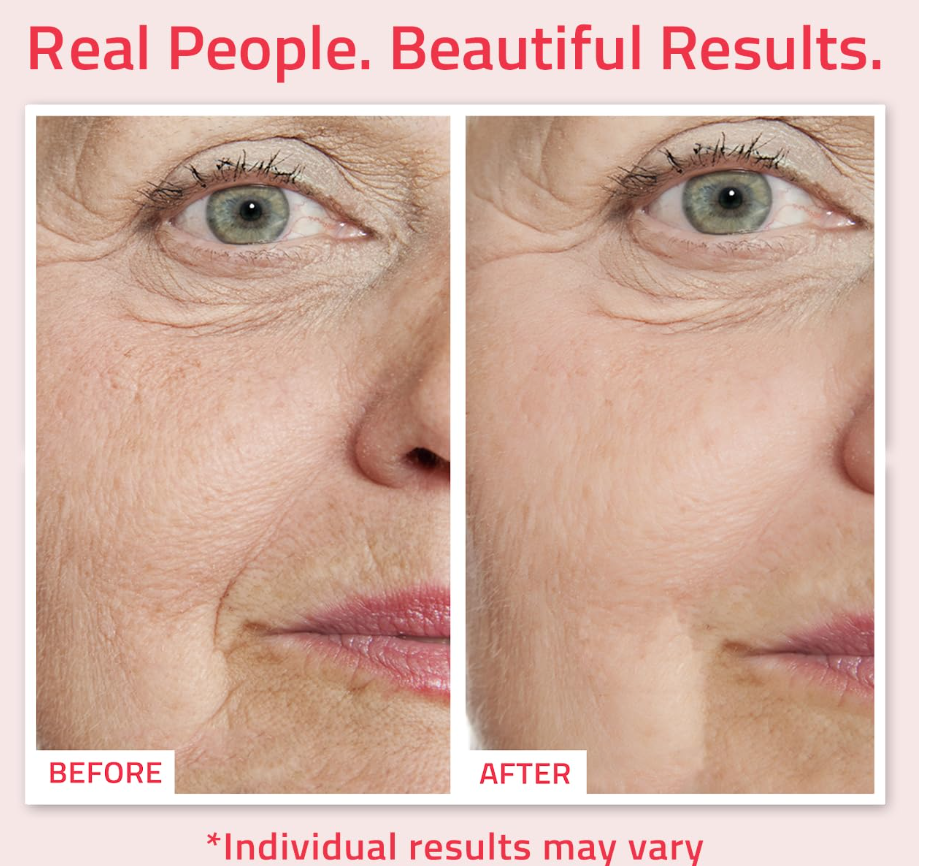 YEOUTH Retinol Serum – Hydrating Face Serum with Hyaluronic Acid & Vitamin E (2oz)