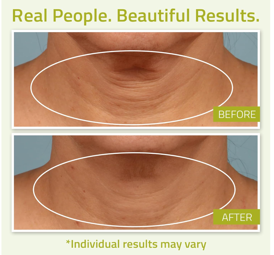 YEOUTH Neck Firming Cream – Vitamin C Moisturizer for Neck & Décolletage (4oz)