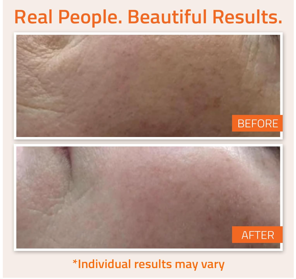 YEOUTH Vitamin C Serum – Brightening Face Serum with Hyaluronic Acid (1oz)