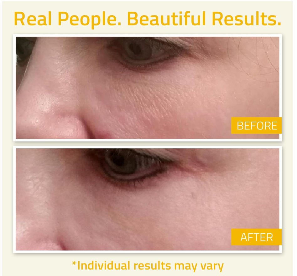 YEOUTH Niacinamide 10% Serum – Hydrating B3 Face Serum with Hyaluronic Acid (2oz)