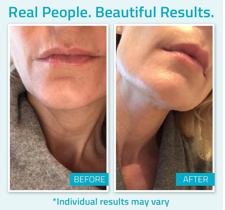 YEOUTH Day & Night Face Moisturizer – Hydrating Cream with Hyaluronic Acid & Snail Mucin (4oz)